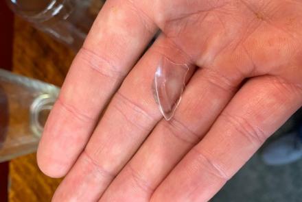 Glass That Caused Esophagus Injury